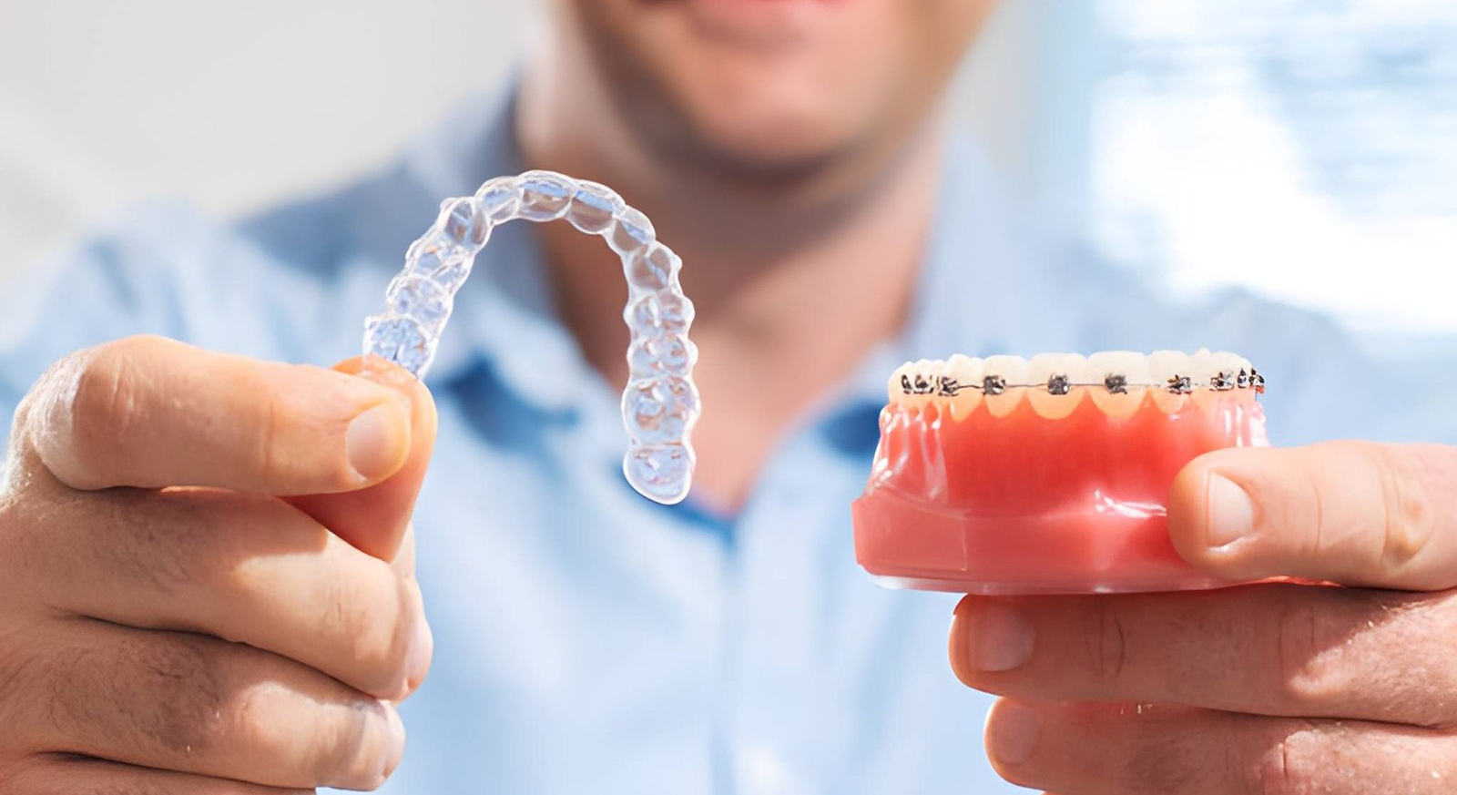 Braces and aligners in Gachibowli