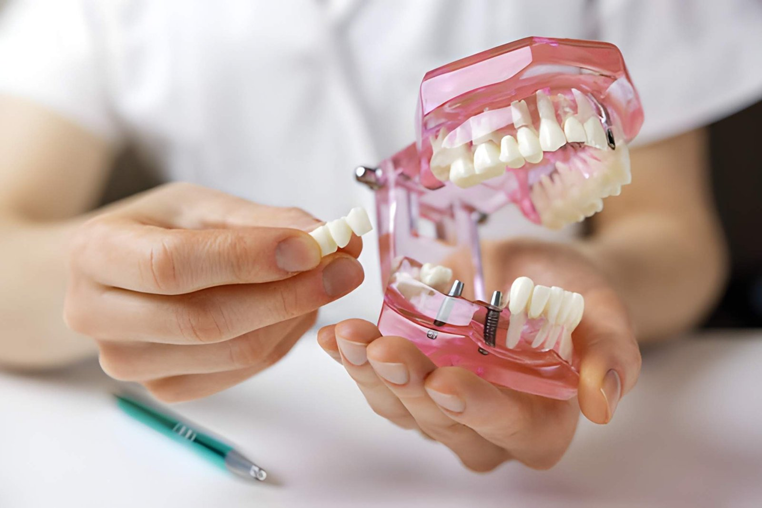 Tooth Bridge treatment