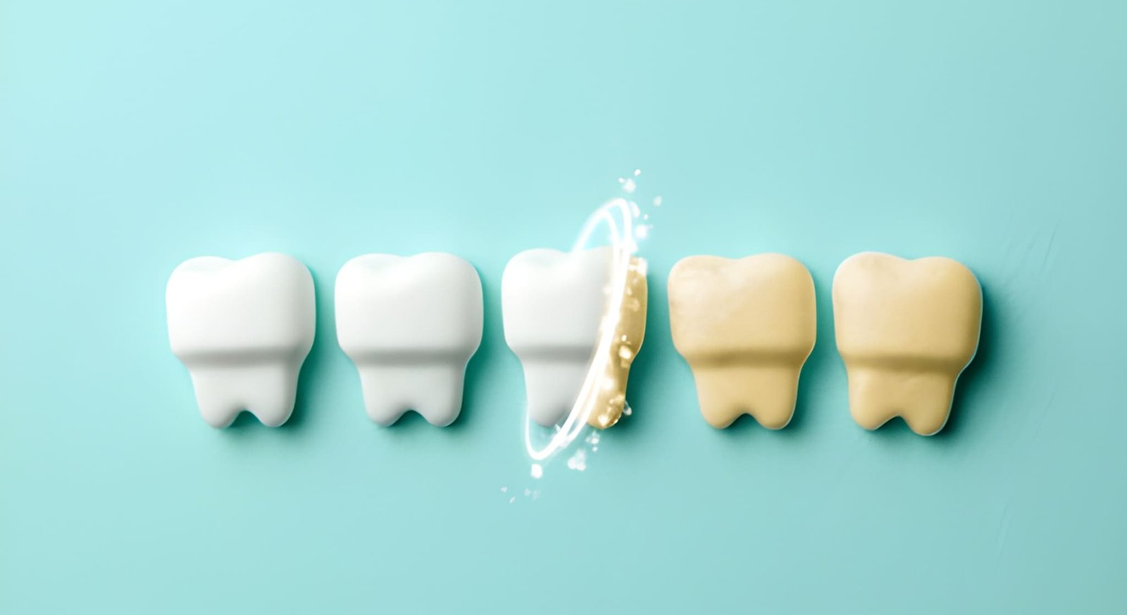 Tooth whitening in Gachibowli