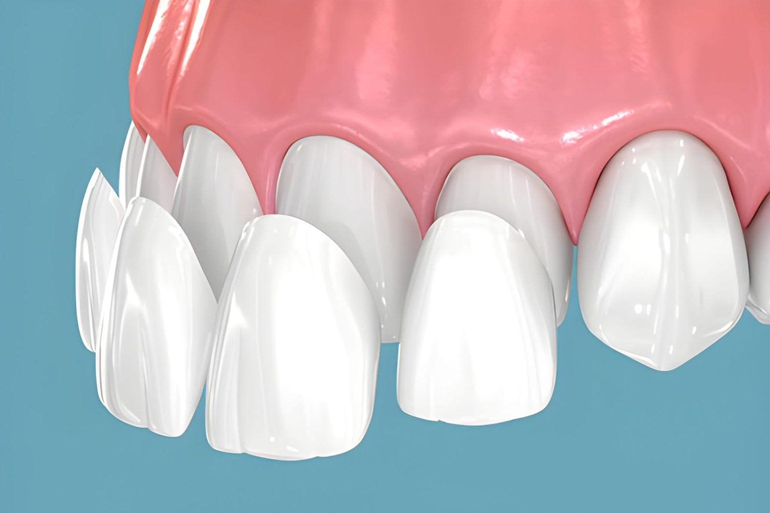 uneven teeth